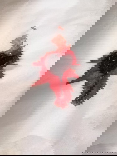 แบบนี้แท้งไหมค่ะ