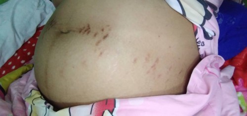 ขอคำปรึกษาค่ะ