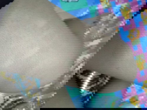 อาการแบบนี้เป็นอะไรค่ะแม่ๆ