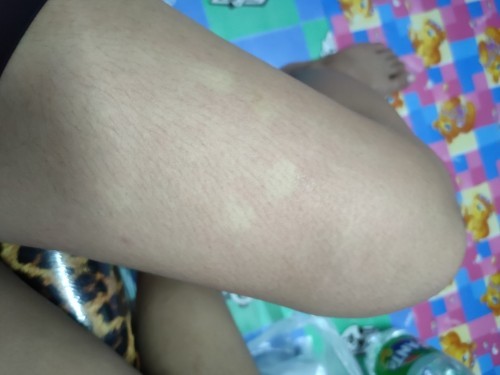 อาการแบบนี้เป็นอะไรค่ะแม่ๆ