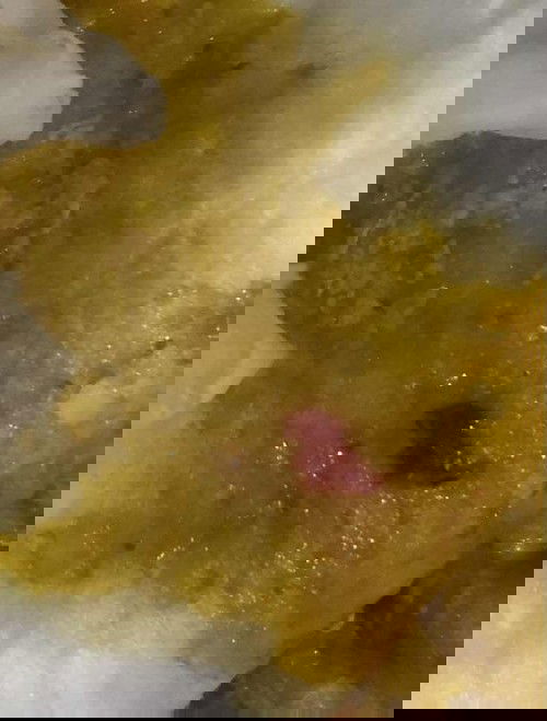 ขอถามแม่ๆคะ มีใครลูกเคยถ่ายเป็นแบบนี้บ้างไหมค่ะ