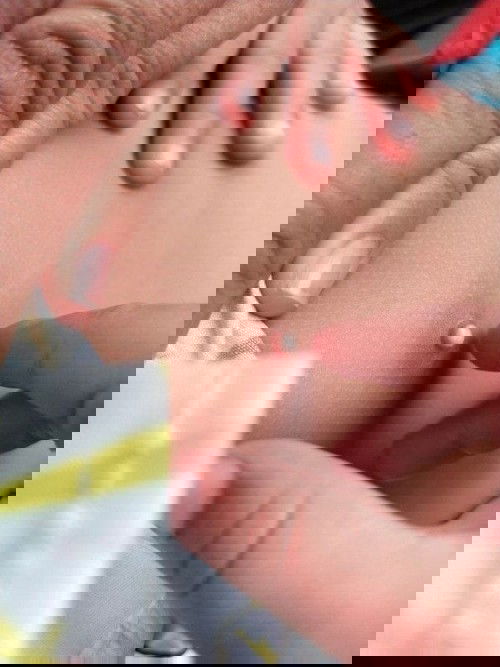 หัวนมลูกแข็งสีขาวคล้ายเม็ดสาคู