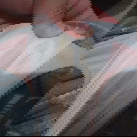 COLOR of discharge