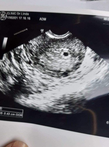 ช่วยดูหน่อยค่ะ