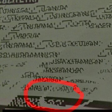 Bertanya soal hasil keterangan dari dokter 🙏