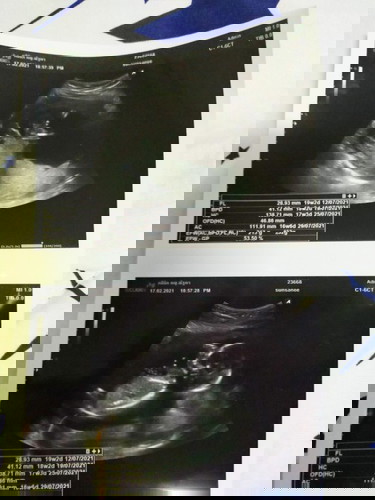 กี่วิค กี่เดือน