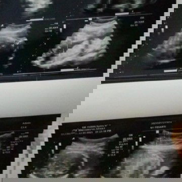 Semoga ada yang jawab 🙏🙏🙏