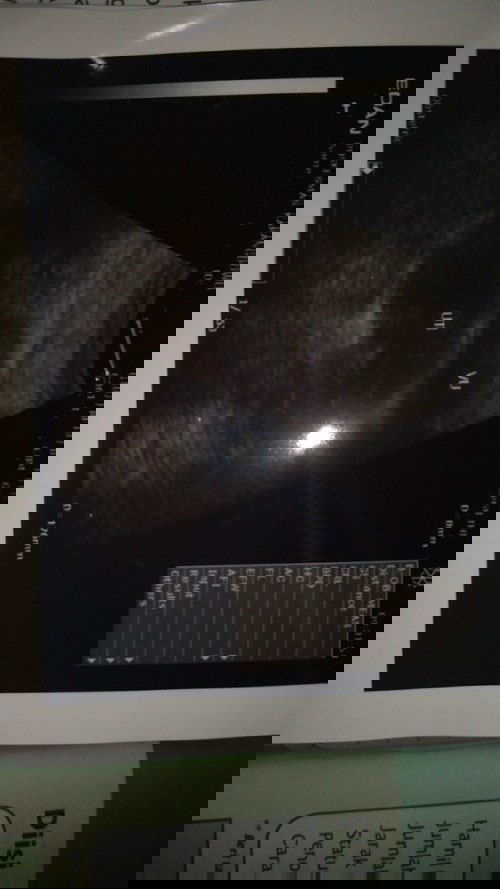 Bun, adakah yg hamil 7minggu tp kantung belum terlihat ??