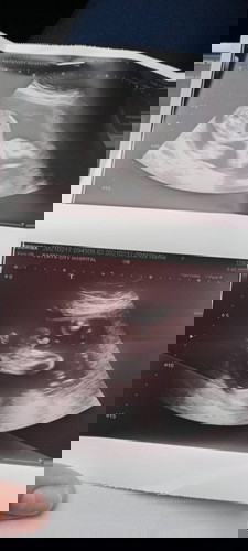 ทีมคลอด มิถุนายนจ้า