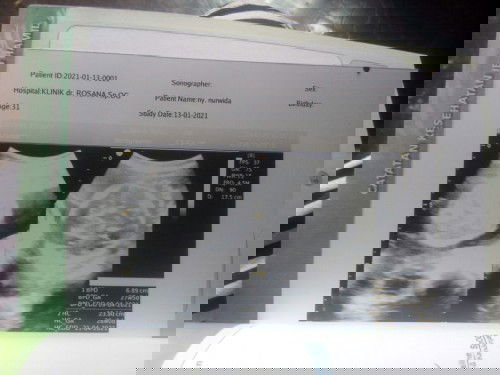 Belum kelihatan jenis kelamin