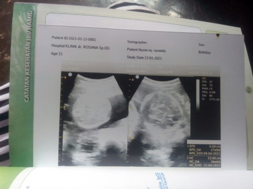 Belum kelihatan jenis kelamin