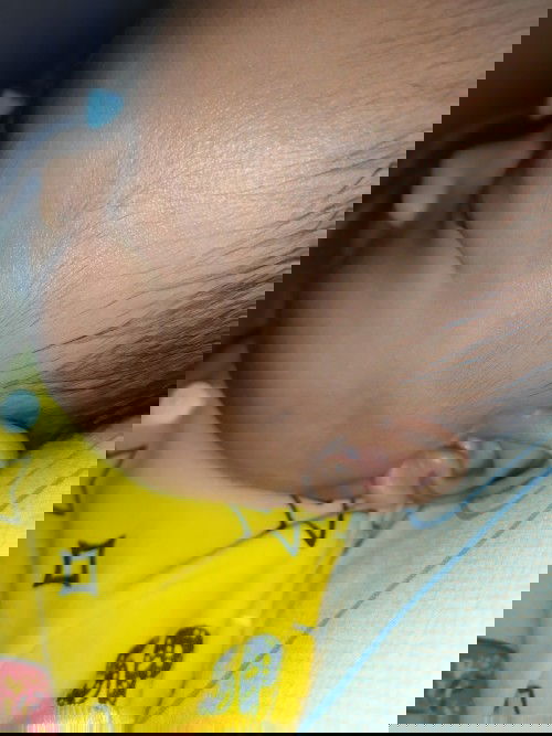 Bercak putih di muka