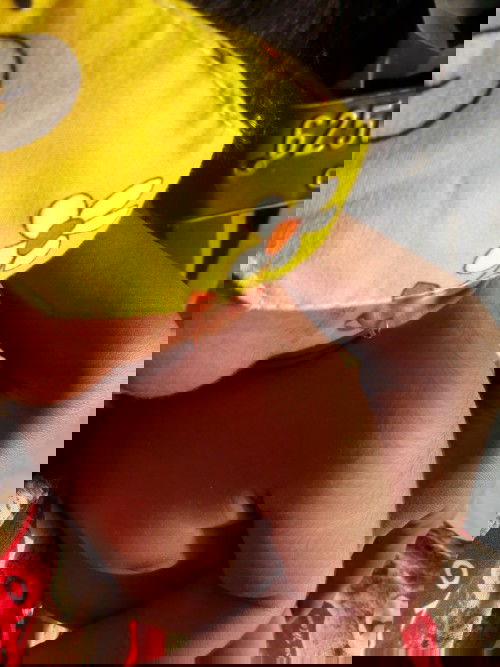 Rambut halus pada bayi