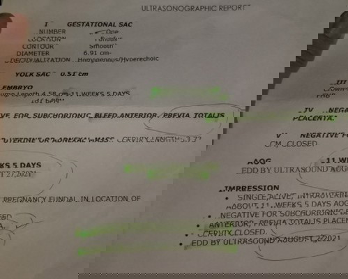 Ultrasound. Sino same case katulad skin?