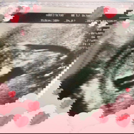 หมอบอกว่าชาย70%หญิง30%ต้องลุ้นเพศอีกไหมคะ