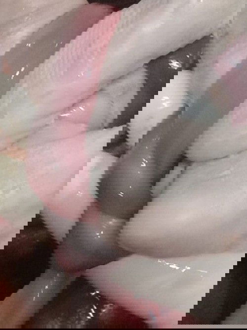 Melahirkan bayi IUFD