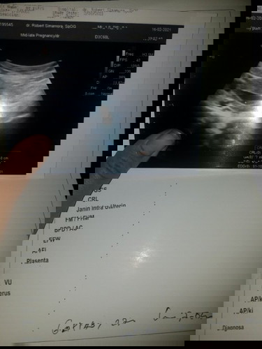 Tu ud 7w lewat 4 d tp kok belum ketauan y jenis klaminya🤔