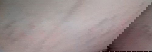 Perut mulai muncul merah-merah