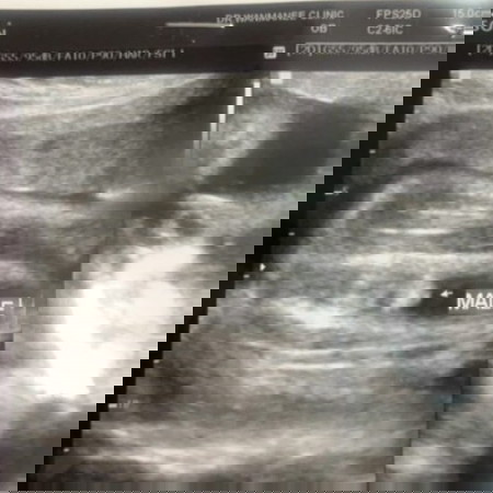 เป็นเด็กชายชัวร์ๆมั้ยคะแม่ๆ 😂😂