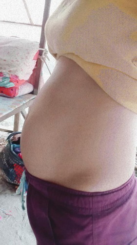 ทำไงดี น้ำหนักแม่ไม่ขึ้น