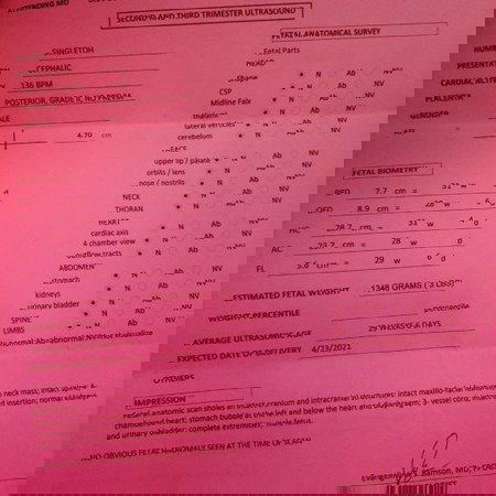 I'm 30 weeks preggy, okay lang po ba ang weight ni baby and ang result ng CAS ko?