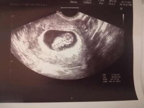 No gestational sac. Only thickened endometrium lang ang nakita at 1st ultrasound.