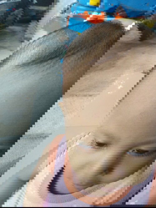 Anak 18 bulan tapi rambutnya belum panjang