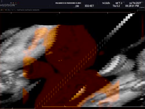 Umbilical cord. need advice 😔