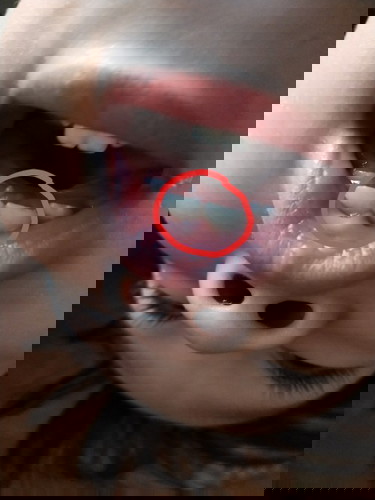 ฟันของลูกน้อย