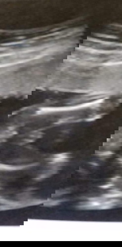 แม่ๆว่าแบบนี้เพศหญิงหรือชายคะ