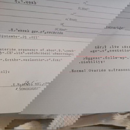 Subchorionic hemorrhage #8weekspreggy