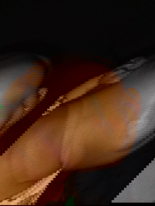 Putih² di kulit bayi seperti panu begini... apa iyah emang panu yah bun?