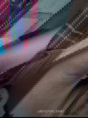 Kilikili babalik pa po ba sa dati?