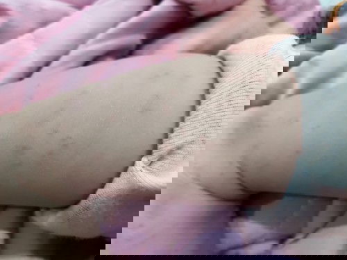 Bé nổi mần đỏ