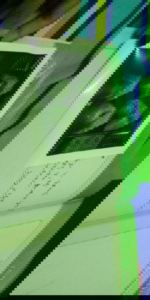 Usg 25w tapi belom terlihat jk