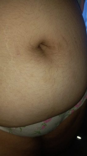 Stretch mark on 4th month pregnancy?