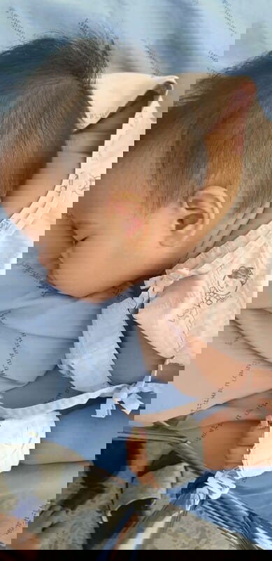 ปอดติดเชื้อ