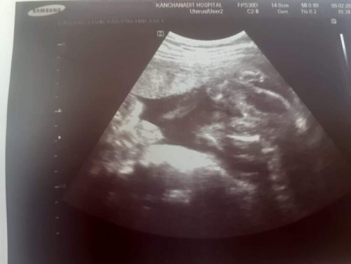 24week6day