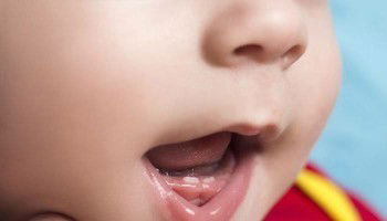 gigi bayi