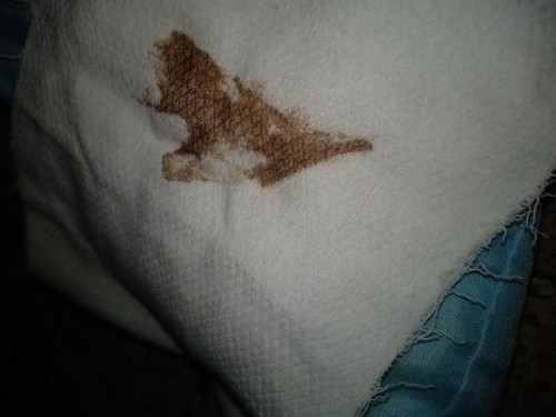 Brown Discharge
19weeks and 1day