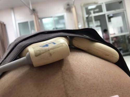 35อาทิต แล้วน้องตัวเล็ก