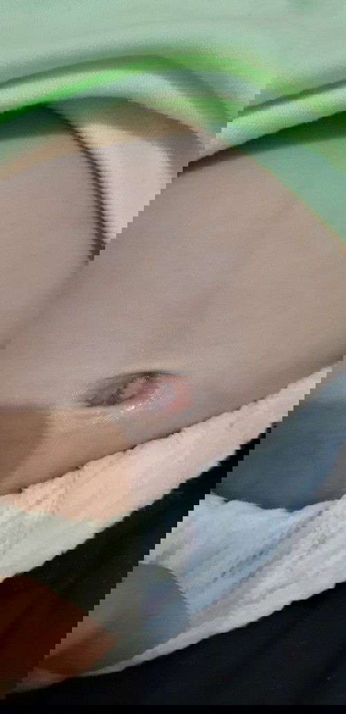 Lobang pusat merah dan basah