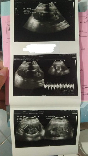 แม่ว่าหญิงหรือชาย