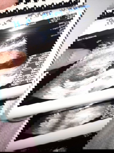 รูปซาวด์เพศ