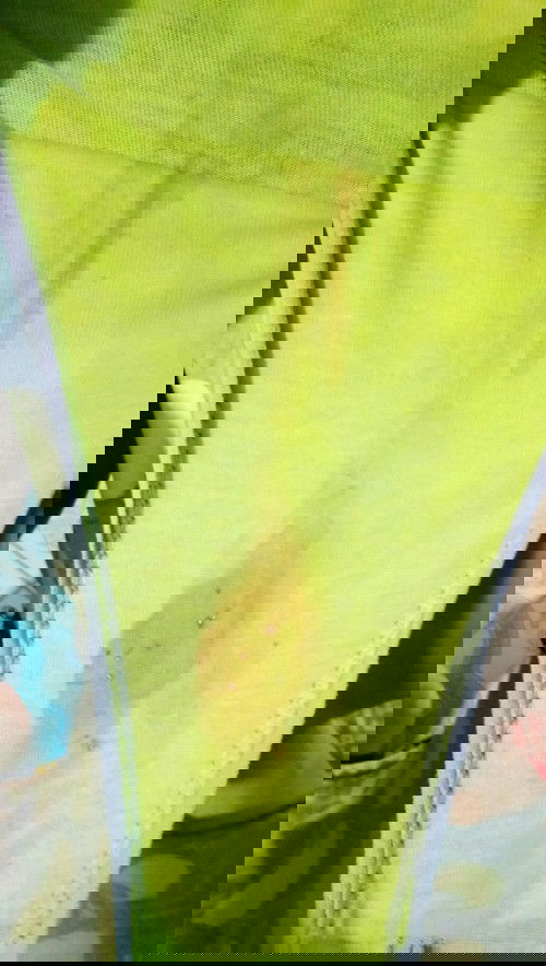 Normal po ba ito
8weeks pregnant. Natatakot po kse ako..