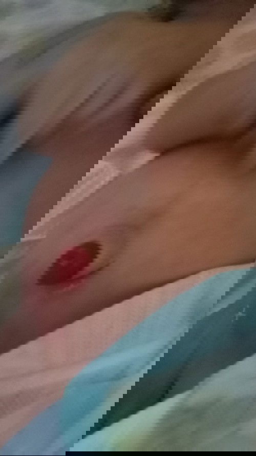 Benjolan merah di pusar bayi