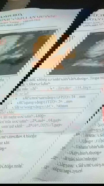 Hôm e khám 28tuần mới đk 1400g có nhỏ lắm k cả nhà