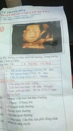 Hôm e khám 28tuần mới đk 1400g có nhỏ lắm k cả nhà
