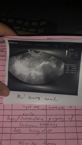 SCAN TAK NAMPAK