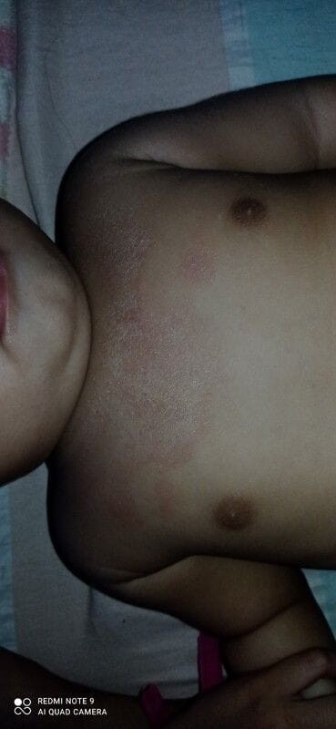 IS THIS RASHES ??